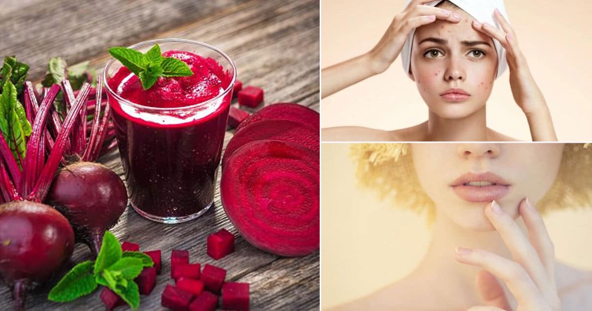 beetroot benefits for skin