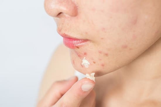 How to Get Rid of Clogged Pores?