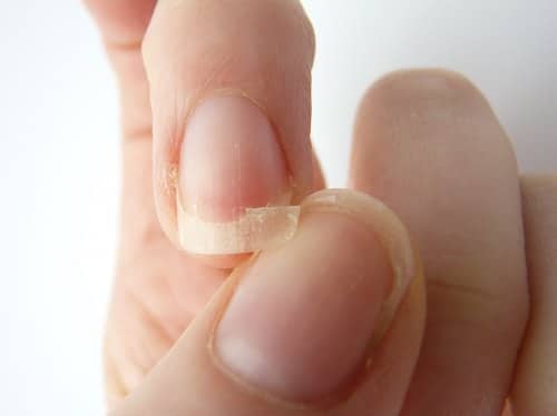 Benefits Of Castor Oil for Nails