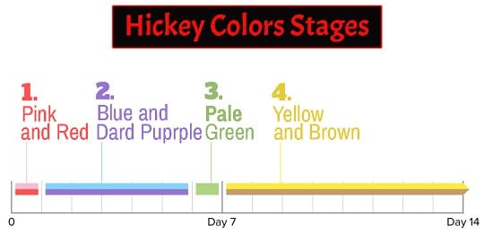 hickey color stages