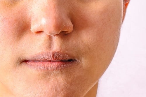 ¿La glicerina obstruye los poros?