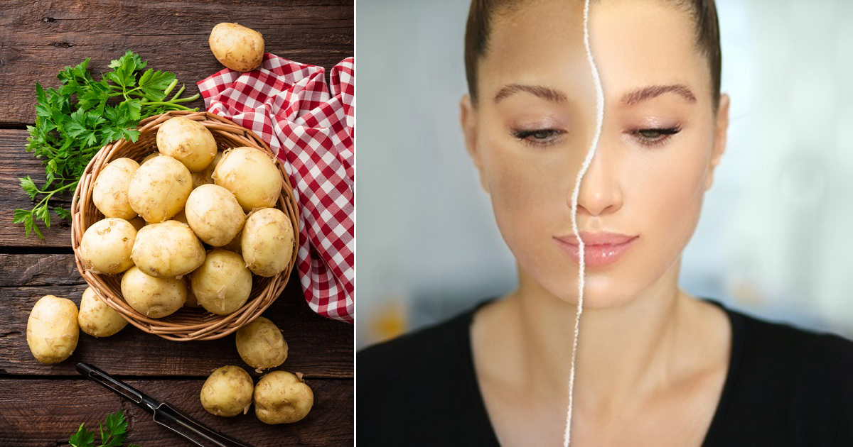How to Use Potato for Skin Lightening ⋆ Bright Stuffs