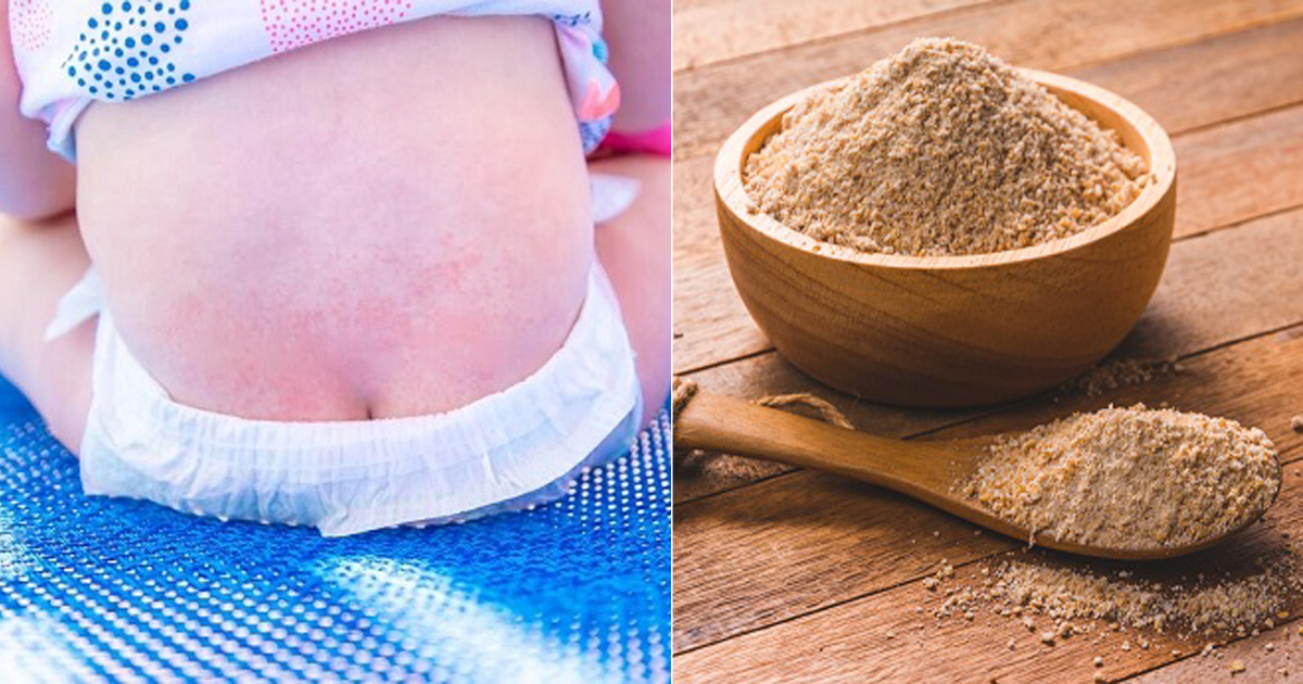 Browned Flour for Diaper Rash Diaper Rash Remedies ⋆ Bright Stuffs